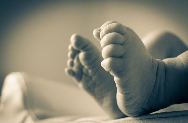 Cesarean Induction Twin birth